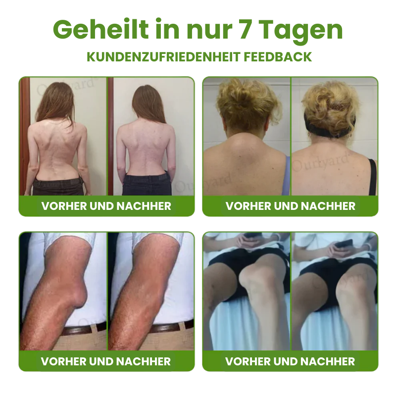 FlexiLind™ | Arthritis-Schmerzlinderung und Knochenheilungssalbe