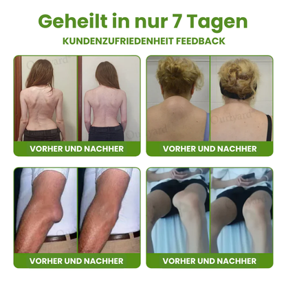 FlexiLind™ | Arthritis-Schmerzlinderung und Knochenheilungssalbe