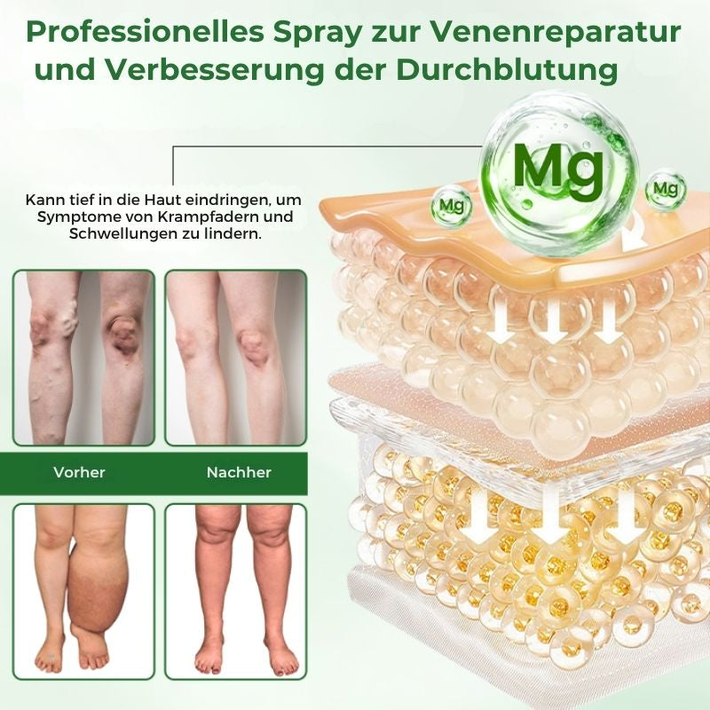 VeinFlex™ | Reduziere Krampfadern um 97 % in nur 2 Wochen!