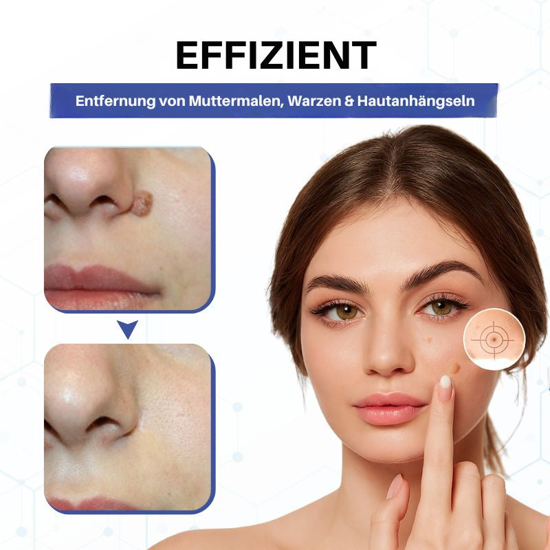 VanishPro™ | Hautpflege zur Entfernung von Hautflecken und Hautanhängseln