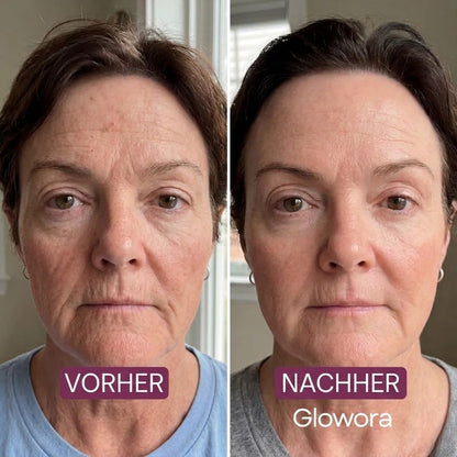 Glowora™ | Peel-off Kollagen-Gesichtsmaske