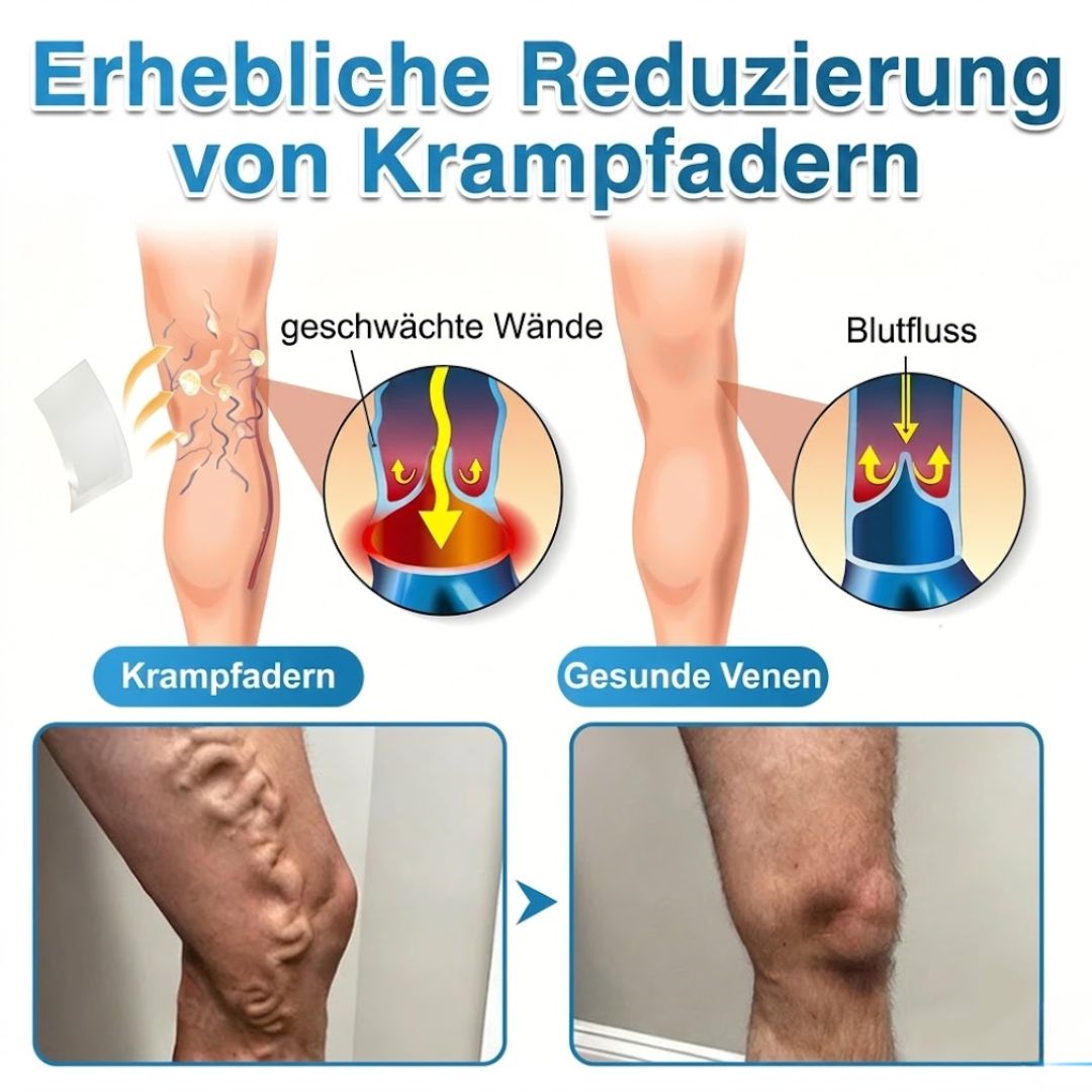 VeinRepair™ | Mikronadel-Pflaster