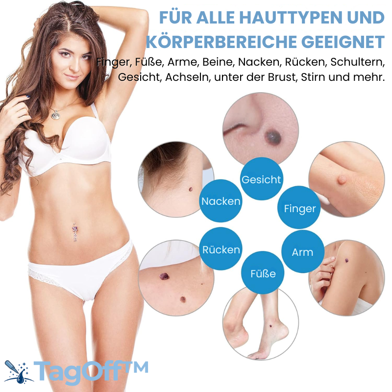 TagOff™ | Komplettset zur Entfernung von Hautanhängseln