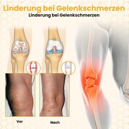 VenomFlex™ | Schmerzcreme mit gereinigtem Bienengift