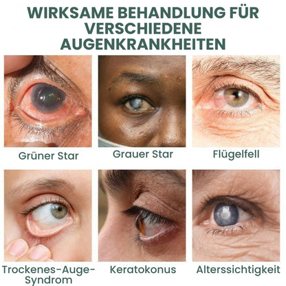 Vision Pro™ | Nano Augentropfen
