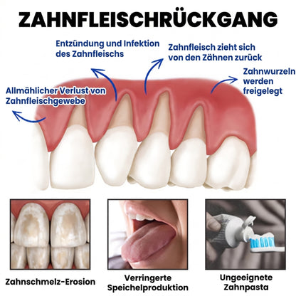 Balancia™ | Bienengift gegen Zahnfleischrückgang