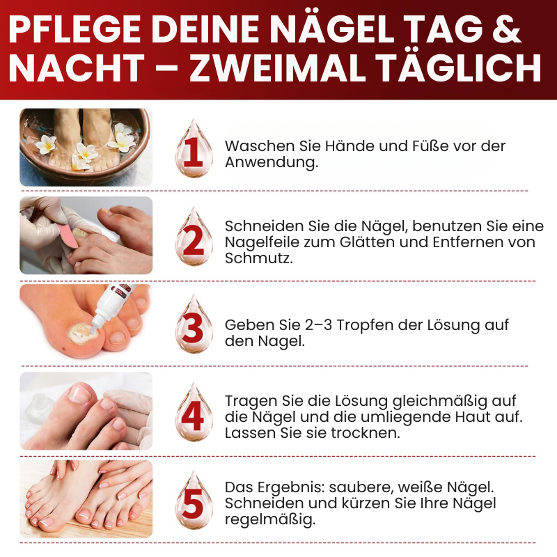 NailGuard™ | Behandlung von Fußnagelpilz