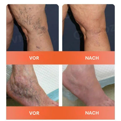 VitaVene™ | Natürliche Venenpflege-Kapseln