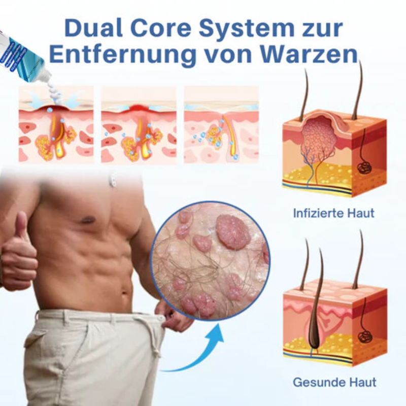 GentCare™ | Creme zur Linderung von Genitalwarzen