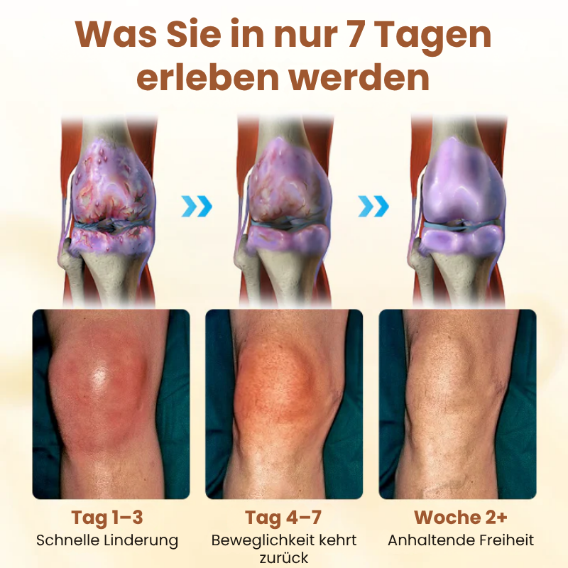 EaseMotion™ | Curcumin-Schmerzlinderungsgel