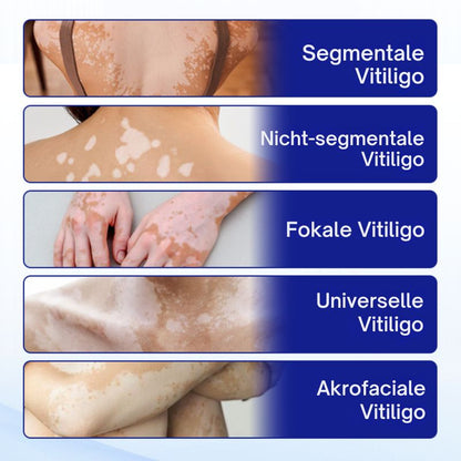VitiClear™ | Unterstützt 3× schnellere Repigmentierung – sichtbare Ergebnisse in 2 Wochen!