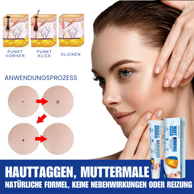 Dermavix™ | Entfernt 97% der Warzen & Hauttaggen in nur 3 Tagen!