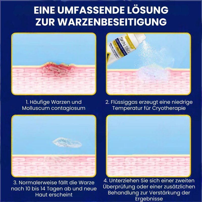 TagFree™ | Cryotherapie Hautanhängsel-Entferner-Spray