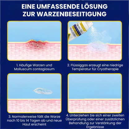 TagFree™ | Cryotherapie Hautanhängsel-Entferner-Spray