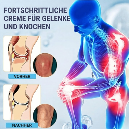 JointRelief™ | Gelenkcreme