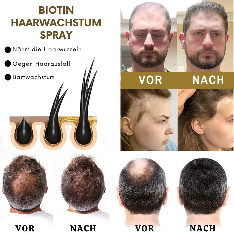 VitaGrow™  | Biotin Haarwuchs-Spray