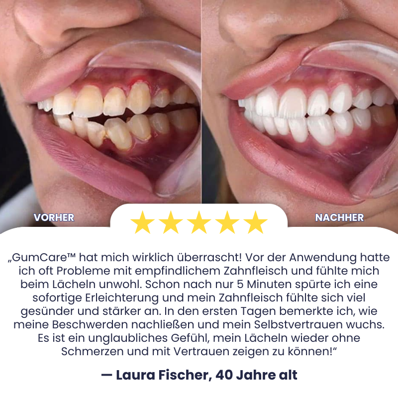 GumCare™ | Rote Lichttherapie-Gerät