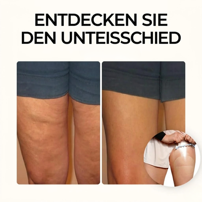LiftPatch™ | unsichtbare Patches