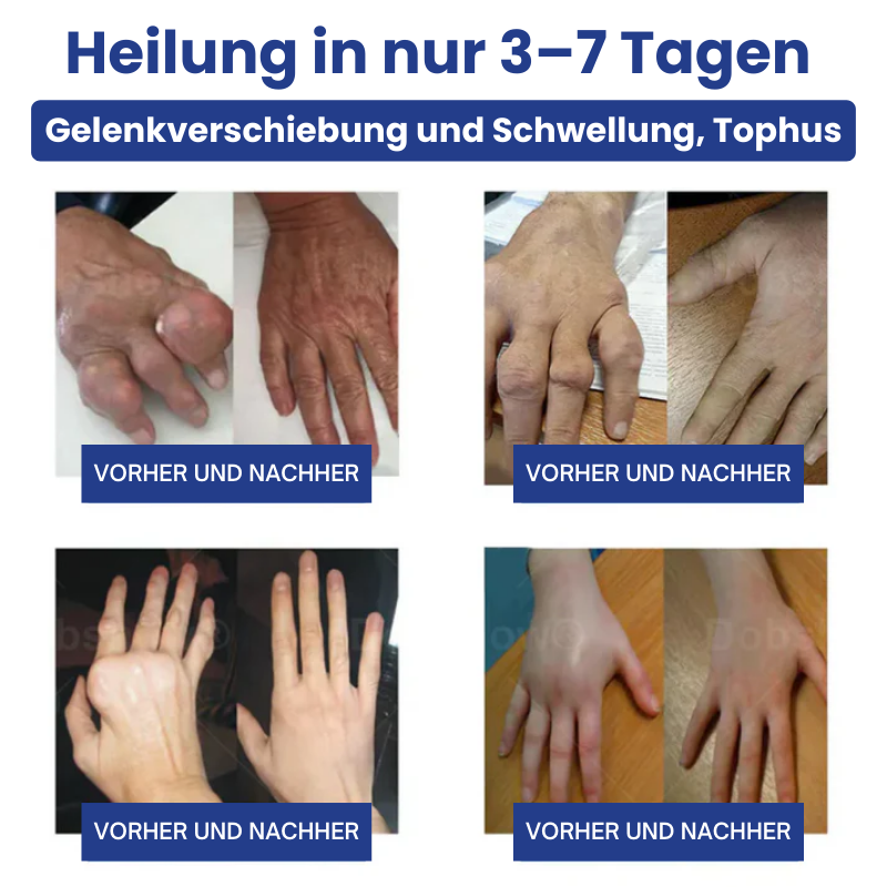 JointHeal™ | Gelenkpflege-Gel-Roller