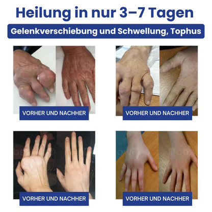 JointHeal™ | Gelenkpflege-Gel-Roller
