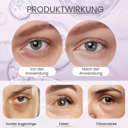 EyeLift™ | Entfernt 98 % aller Augenringe & Falten sofort!