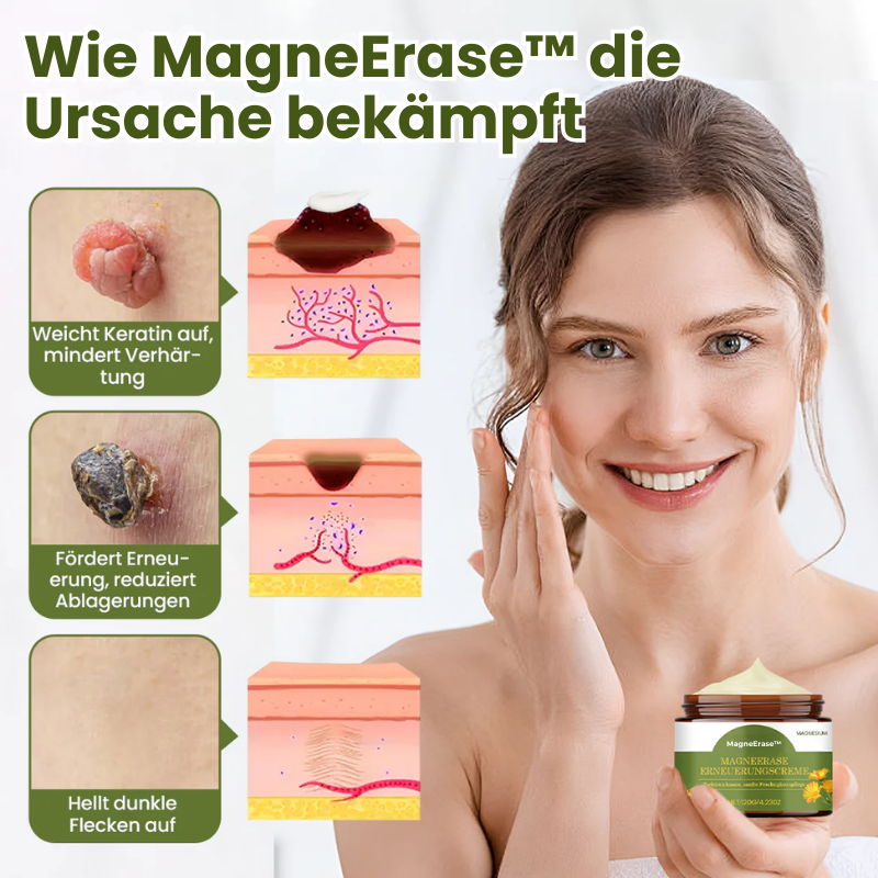 MagneErase™ | Magnesium Hauterneuerungs-Creme