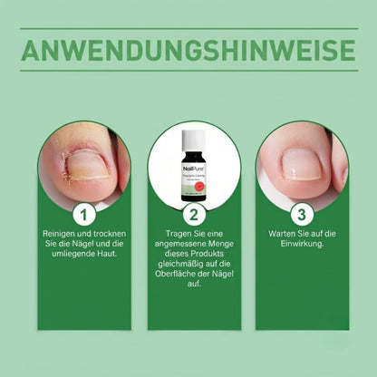 NailPure™  | Nagelpilz-Lösung