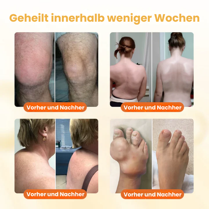 VenomFlex™ | Schmerzcreme mit gereinigtem Bienengift