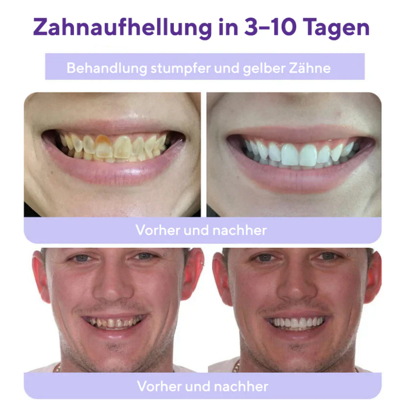 HydroDent™ | Beseitigt 97 % aller Karies und Zahnempfindlichkeit in nur 5 Tagen!