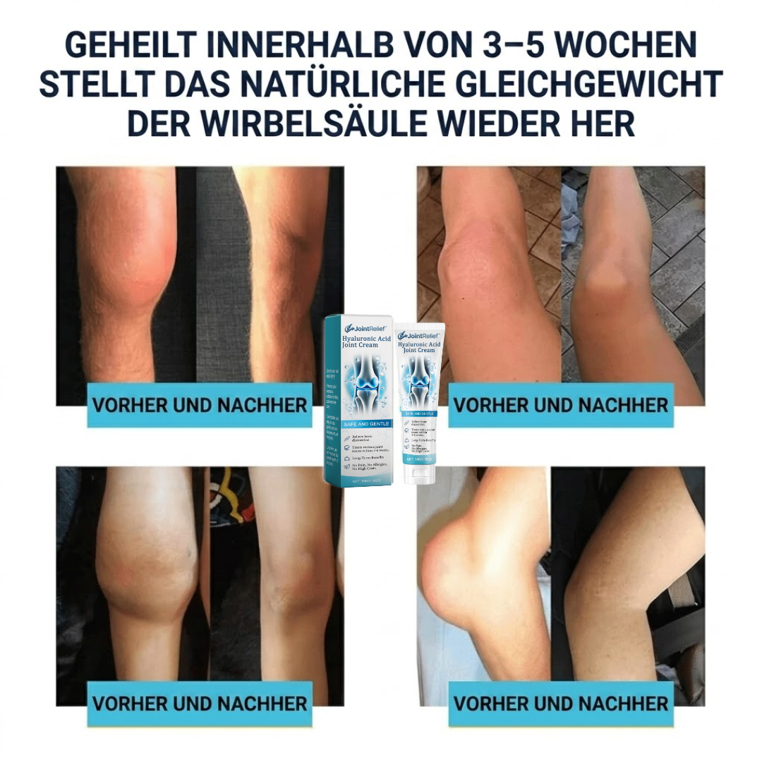 JointRelief™ | Gelenkcreme
