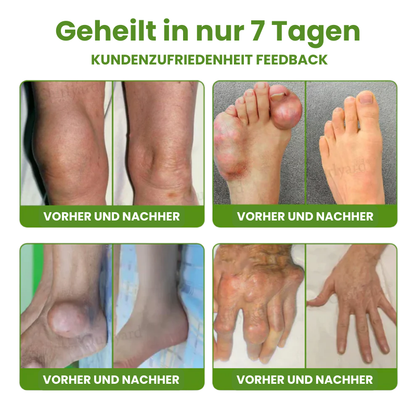 FlexiLind™ | Arthritis-Schmerzlinderung und Knochenheilungssalbe