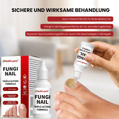 NailGuard™ | Behandlung von Fußnagelpilz