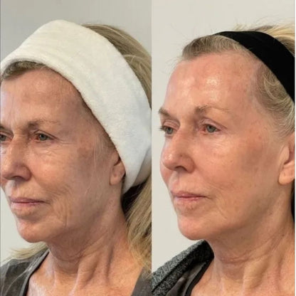 YouthGlow™ | Anti-Aging-Serum