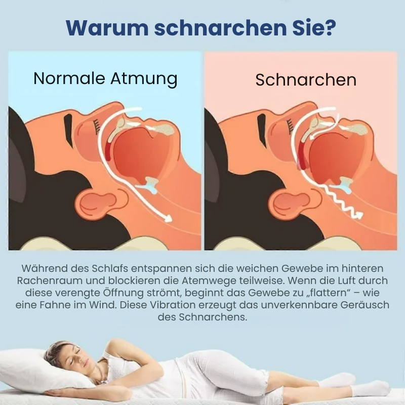 SnoreFree™ | Anti-Schnarch-Mundstück