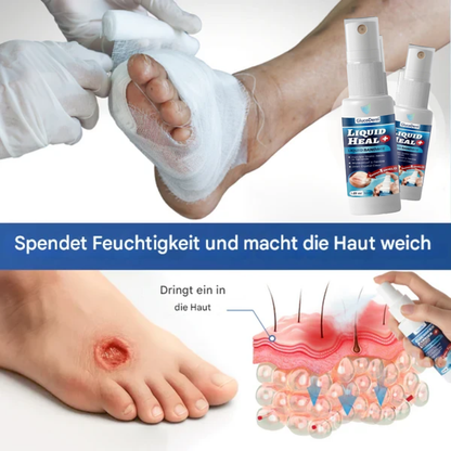 GlucoDerm™ | Wundreinigungsspray