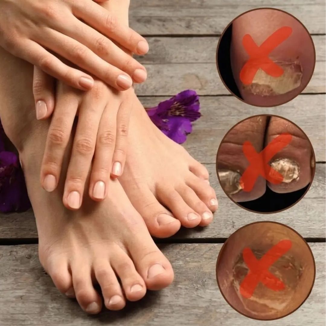 NailPure™  | Nagelpilz-Lösung