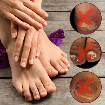 NailPure™  | Nagelpilz-Lösung