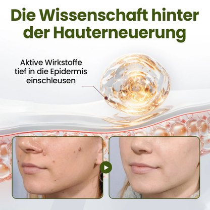 MagneErase™ | Magnesium Hauterneuerungs-Creme