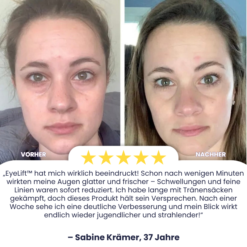 EyeLift™ | Entfernt 98 % aller Augenringe & Falten sofort!