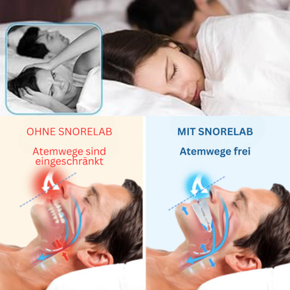 SnoreFree™ | Anti-Schnarch-Mundstück