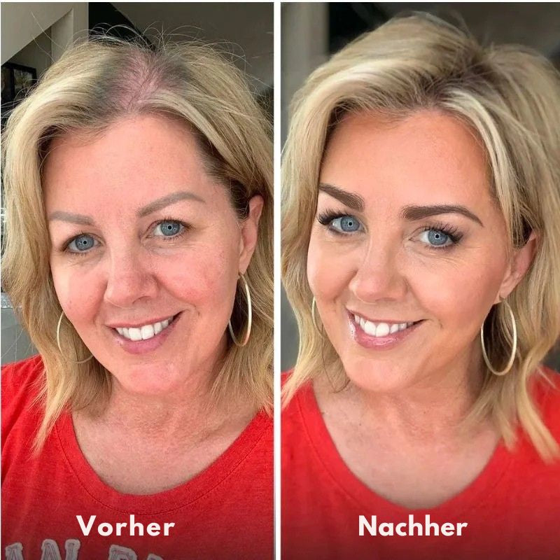 HairRestore™ | Haarstärkendes Spray