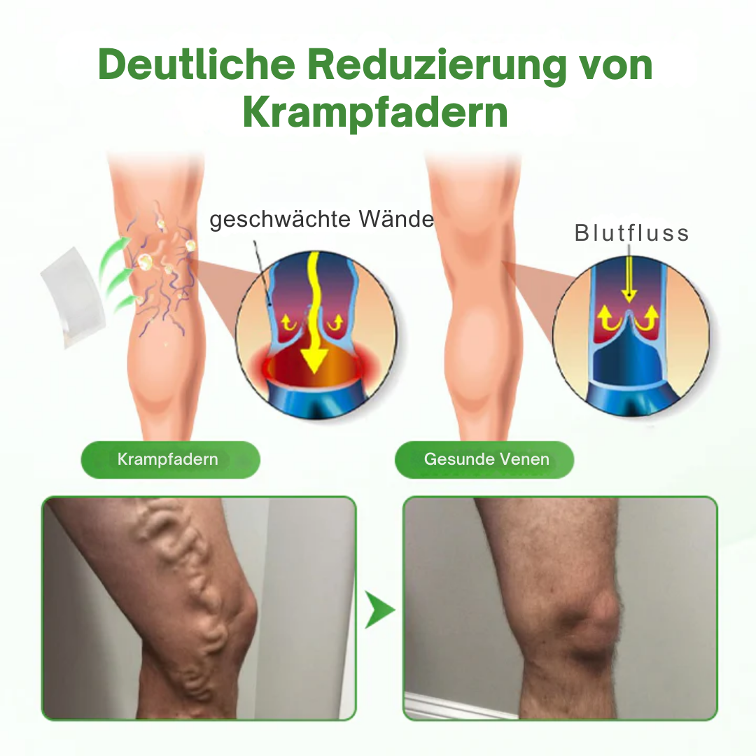 VienHeal™ | Mikronadel-Pflaster