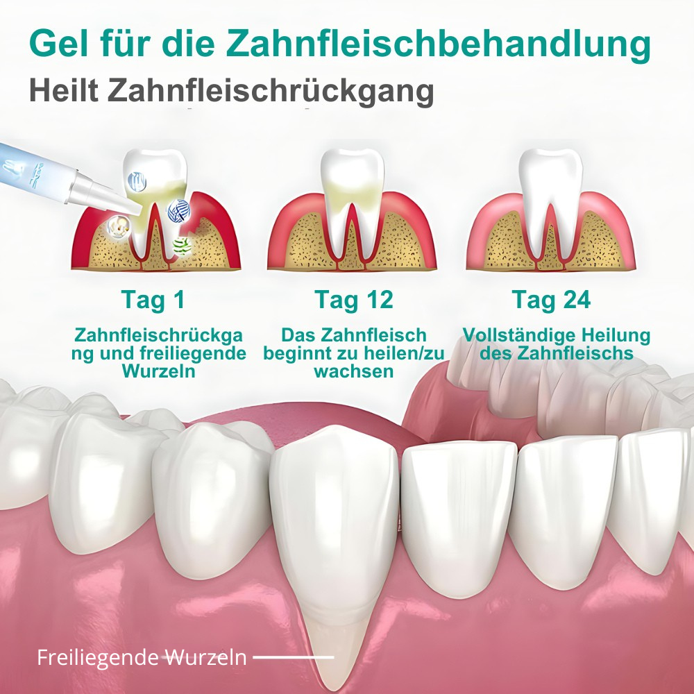 GumLux™ Teeth Repair Gel