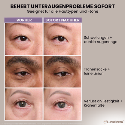 LuméVera™ | Eye-Lift-Creme
