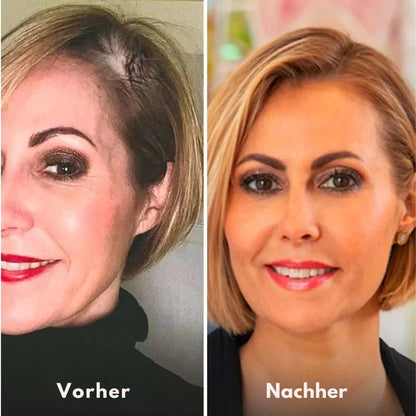 HairRestore™ | Haarstärkendes Spray