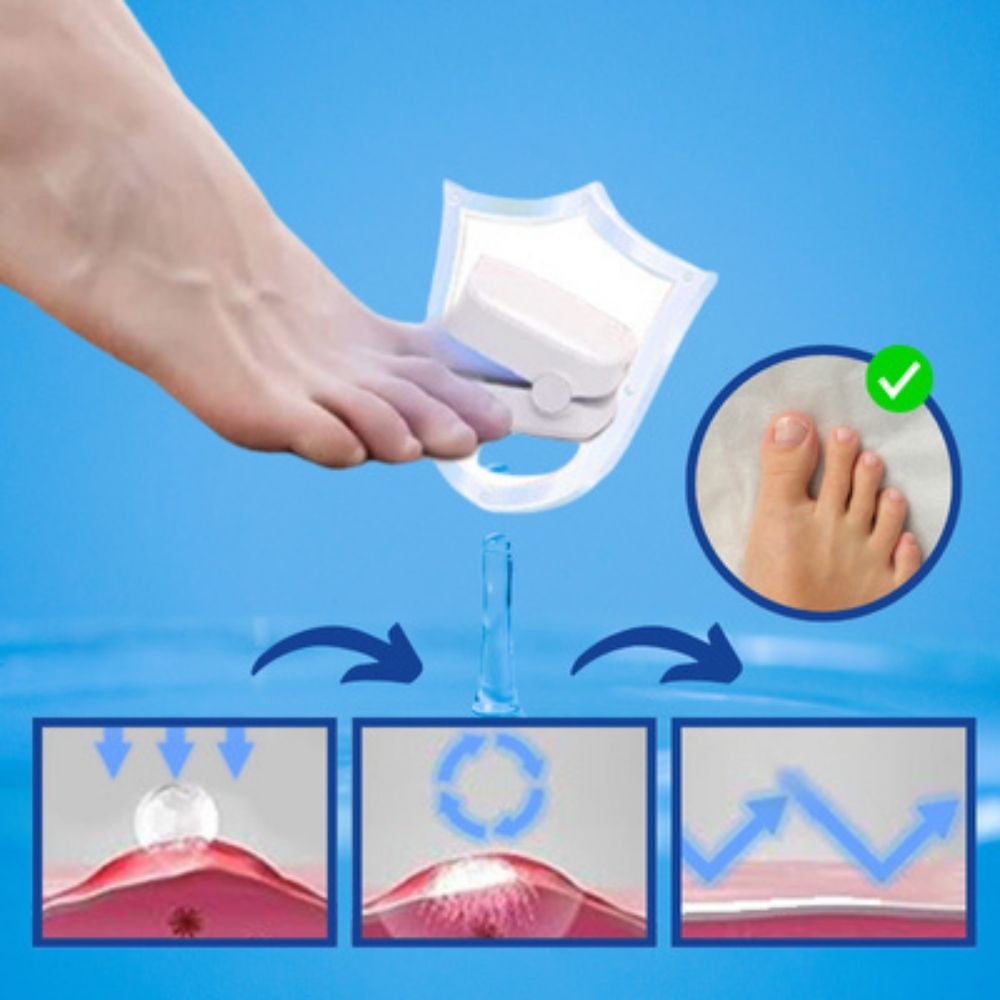 LaserKlar™ | Medizinischer Nagelpilz-Laser