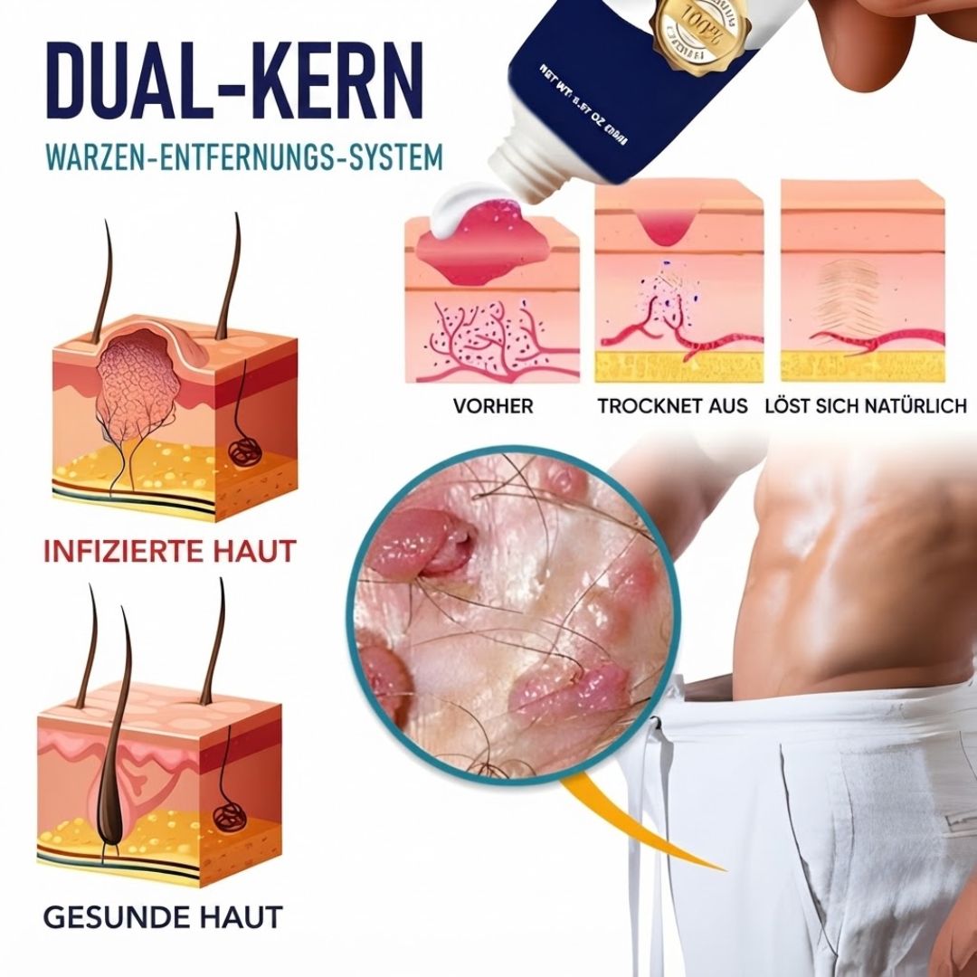 SureClear™  | Genitalwarzen-Entfernungscreme