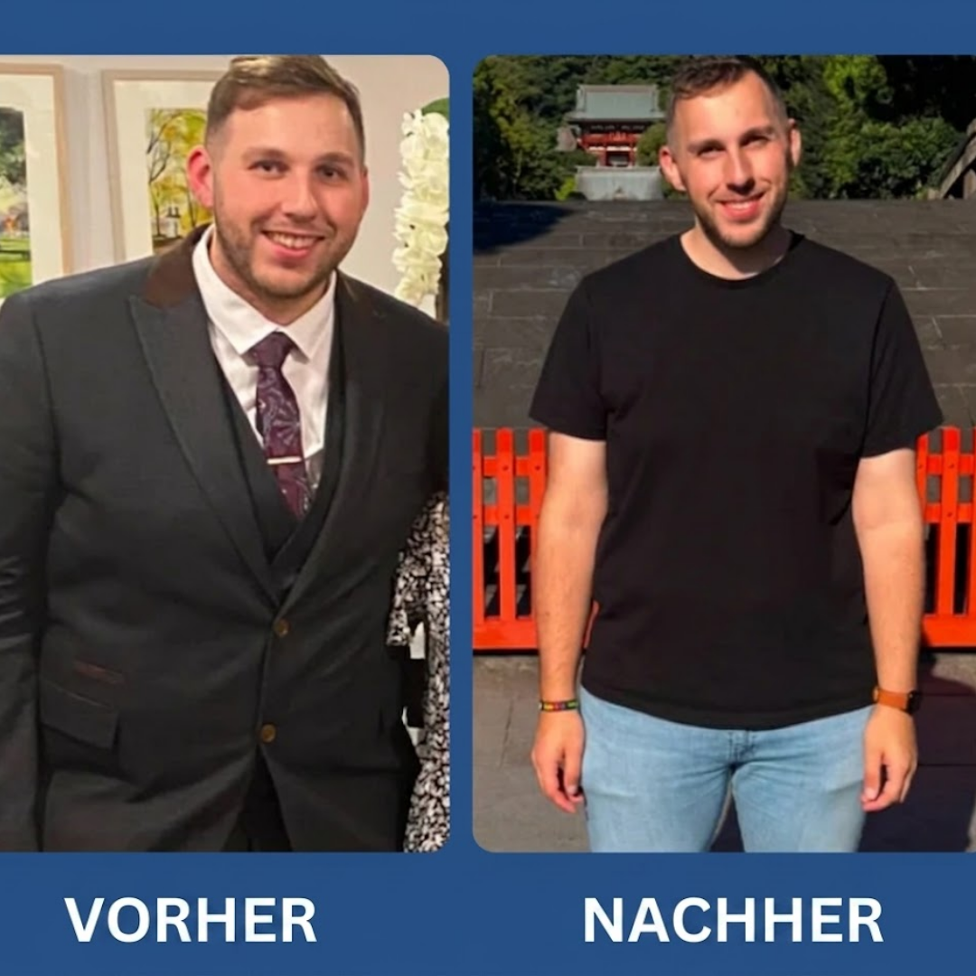 GLP-Active™ | Unterstützung beim Fettabbau