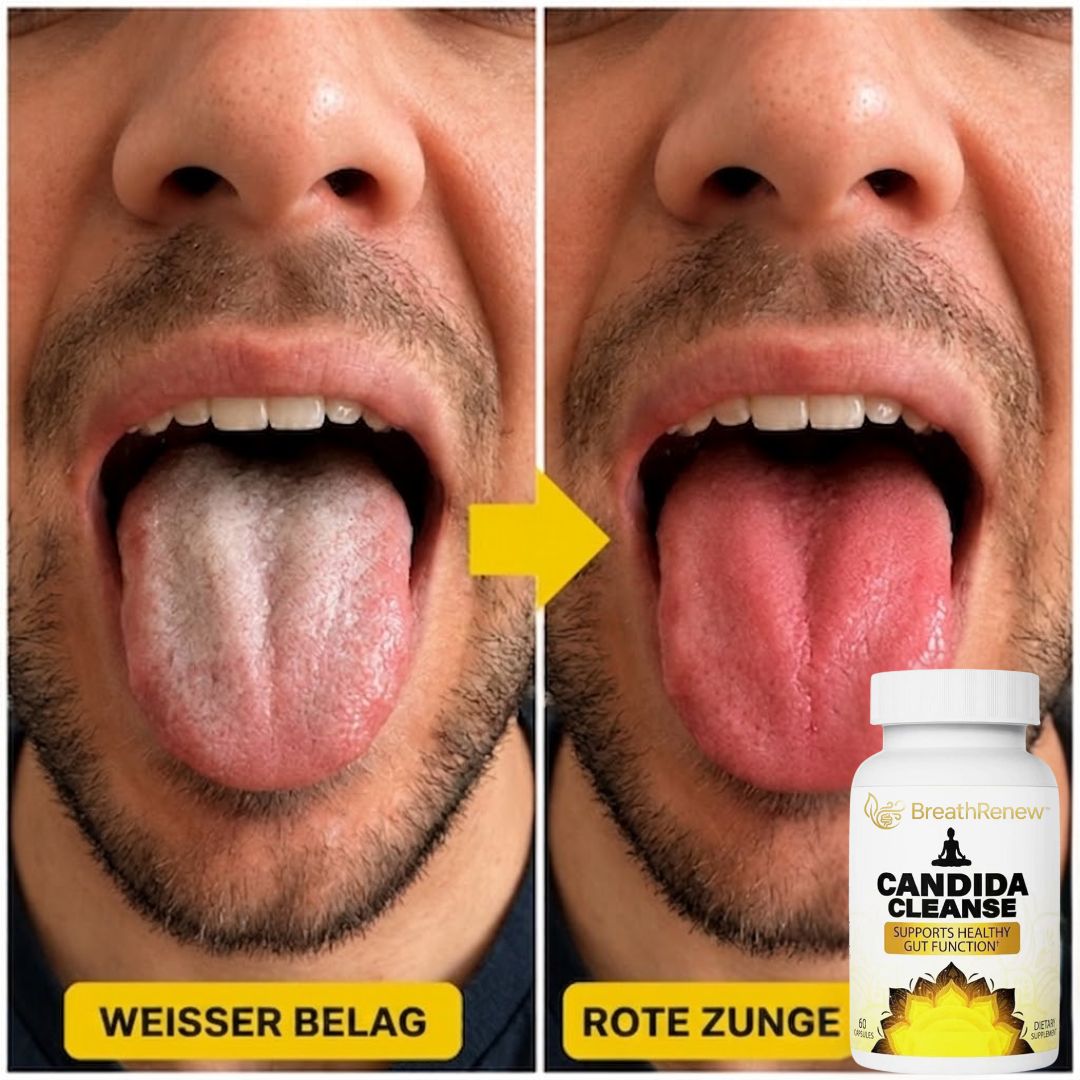 BreathRenew™ | Kapseln gegen Mundgeruch