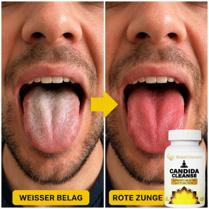 BreathRenew™ | Kapseln gegen Mundgeruch